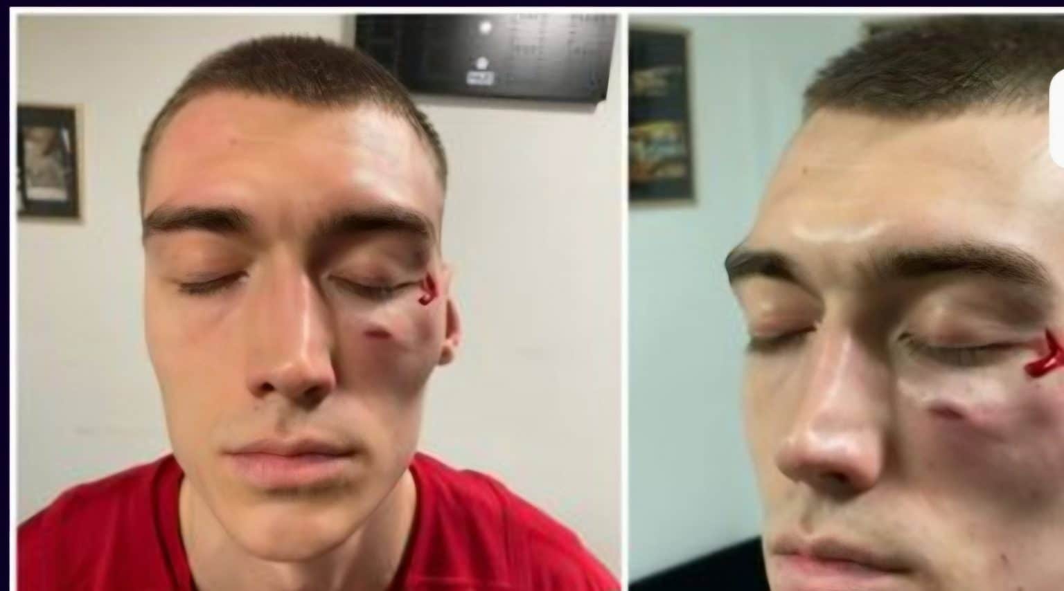 UŽAS PRED VEČITI DERBI! Naneli (PAR) napao Lazarevića (CZV) i udario ga šakom! (VIDEO/TELEGRAF/INFORMER)